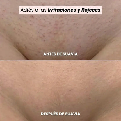 Afeitadora SUAVIA®